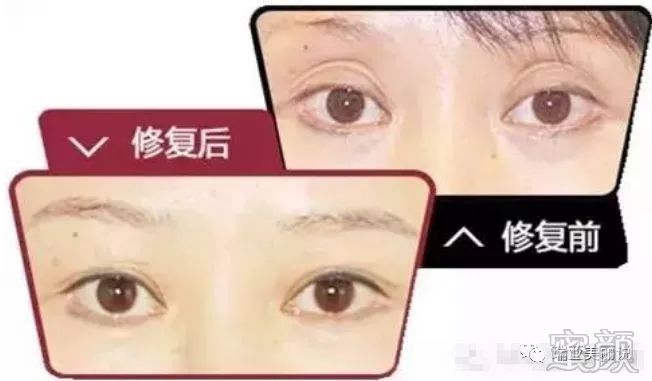 https://img.miyanlife.com/mnt/timg/191226/1520124H4-7.jpg