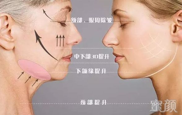 https://img.miyanlife.com/mnt/timg/191226/15445aF2-5.jpg
