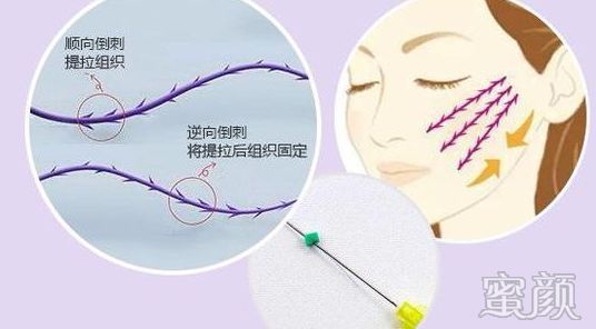 https://img.miyanlife.com/mnt/timg/191226/1545014a6-7.jpg