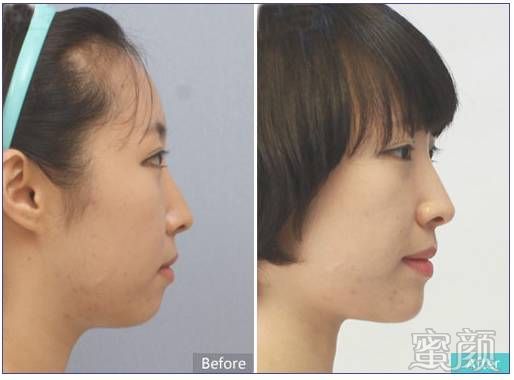 https://img.miyanlife.com/mnt/timg/191226/155211OD-6.jpg