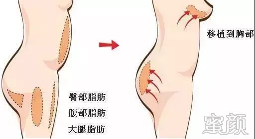 https://img.miyanlife.com/mnt/timg/191227/13245H140-3.jpg