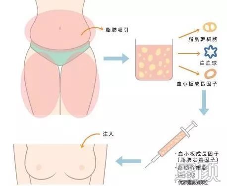 https://img.miyanlife.com/mnt/timg/191227/13245JP0-2.jpg
