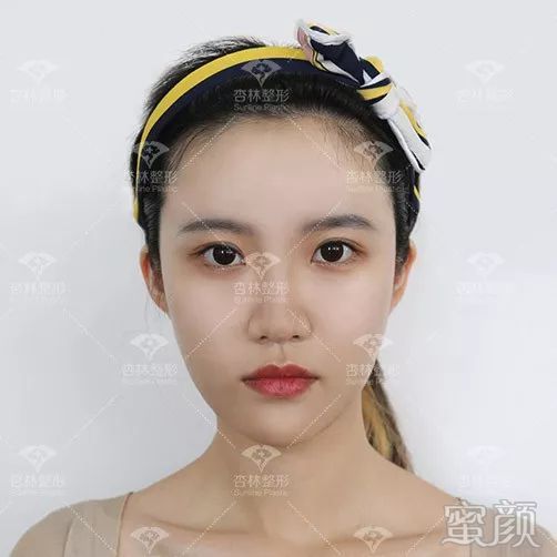 https://img.miyanlife.com/mnt/timg/191228/14542U0L-6.jpg