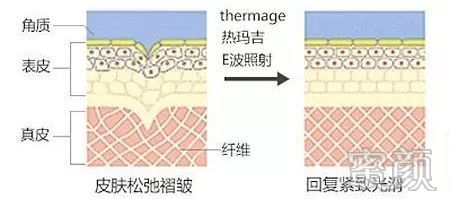 https://img.miyanlife.com/mnt/timg/191228/145A25000-6.jpg