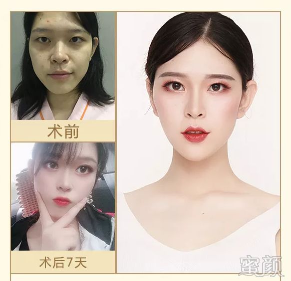 https://img.miyanlife.com/mnt/timg/191228/1515256056-5.jpg