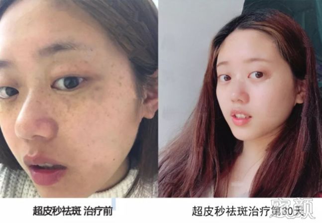 https://img.miyanlife.com/mnt/timg/191228/1515293637-8.jpg