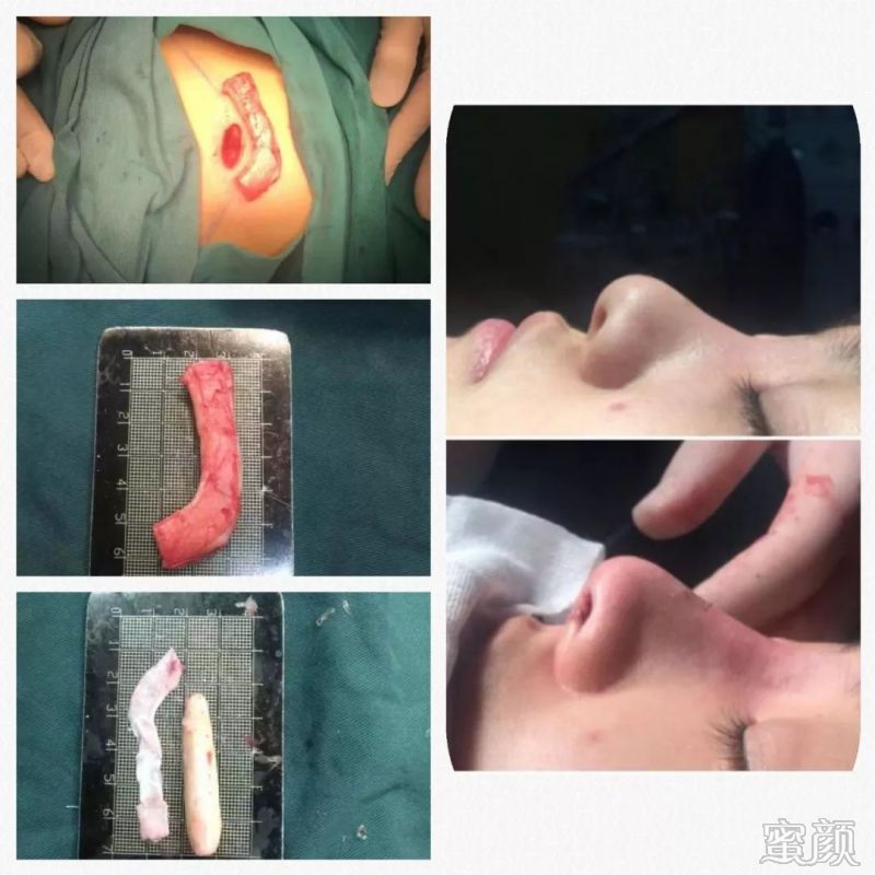 https://img.miyanlife.com/mnt/timg/191228/15152W3b-7.jpg