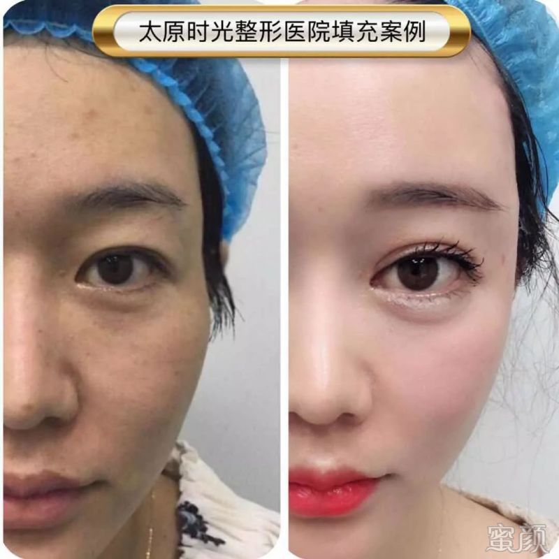 https://img.miyanlife.com/mnt/timg/191228/15152a117-9.jpg