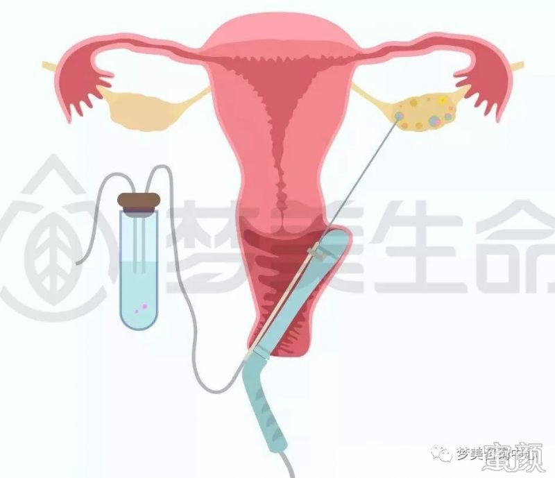 https://img.miyanlife.com/mnt/timg/191228/1H35a433-2.jpg