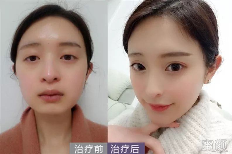 https://img.miyanlife.com/mnt/timg/191229/11525J548-9.jpg