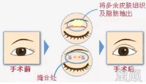 案例图片