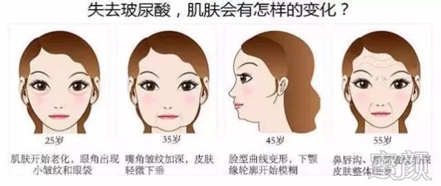 https://img.miyanlife.com/mnt/timg/191230/152440LR-0.jpg