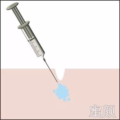 https://img.miyanlife.com/mnt/timg/191230/15244152a-2.jpg