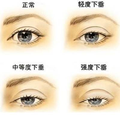 https://img.miyanlife.com/mnt/timg/191231/124441D93-4.jpg