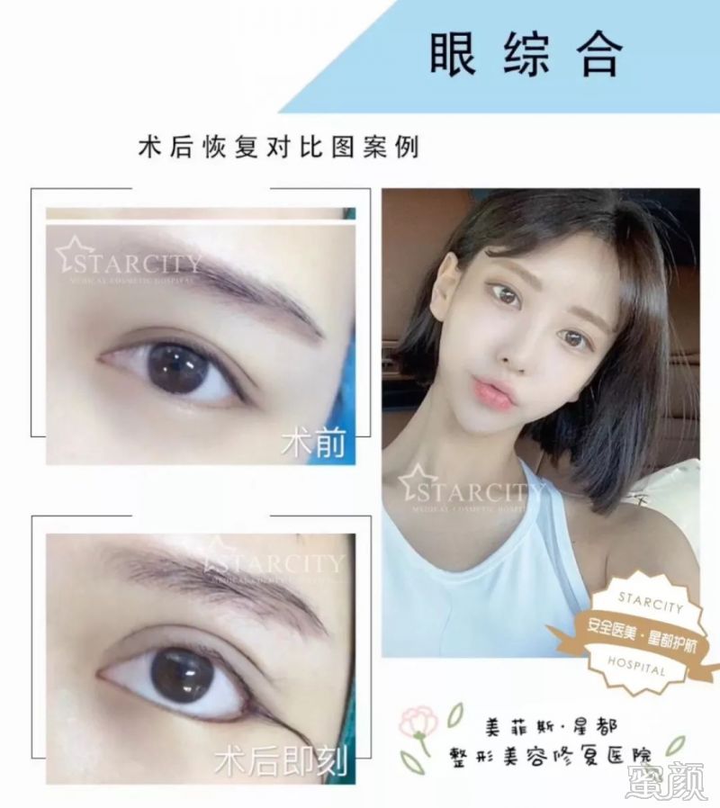 https://img.miyanlife.com/mnt/timg/191231/1244422956-8.jpg