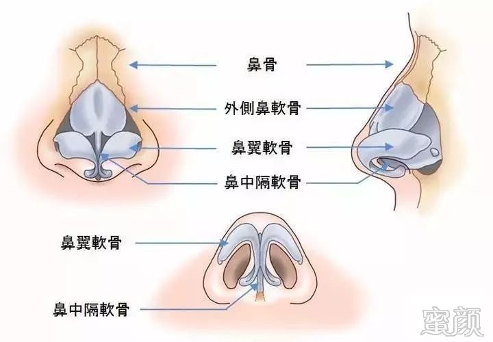 案例图片