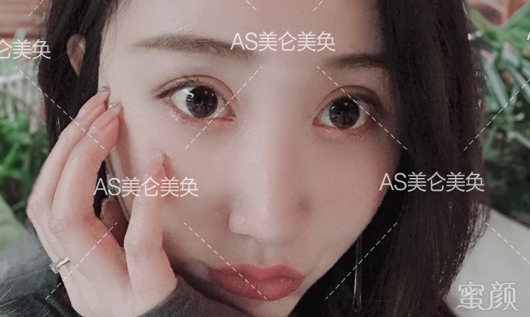 https://img.miyanlife.com/mnt/timg/191231/151H432O-12.jpg