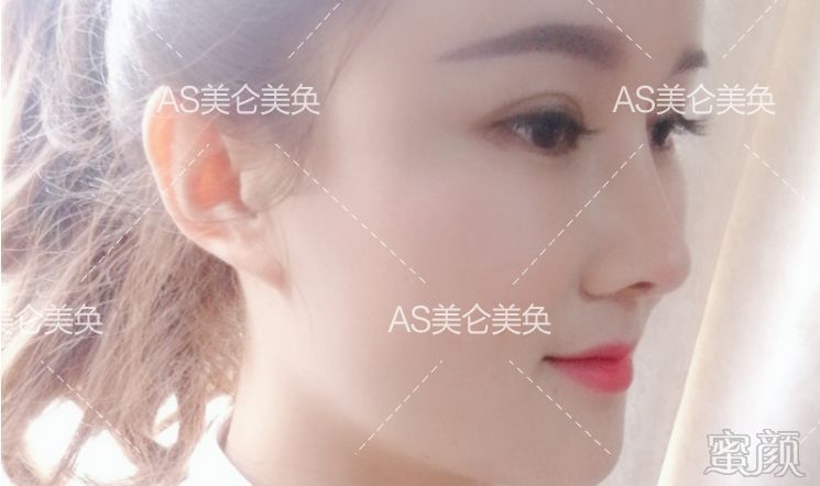 https://img.miyanlife.com/mnt/timg/191231/151H513H-13.jpg