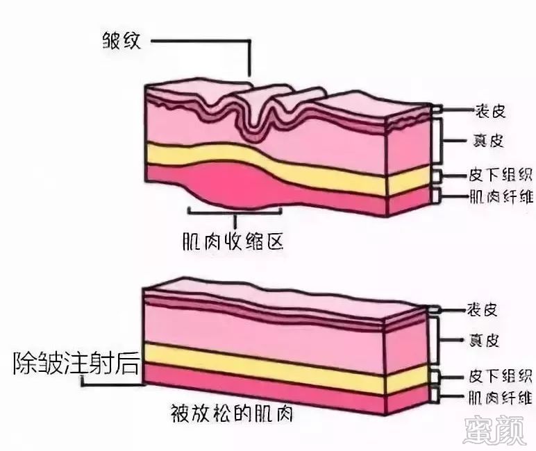https://img.miyanlife.com/mnt/timg/191231/152143KD-8.jpg