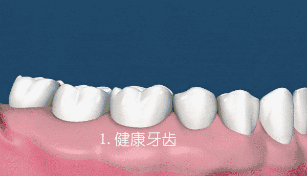 https://img.miyanlife.com/mnt/timg/200101/15294HP7-5.gif