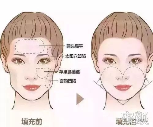 https://img.miyanlife.com/mnt/timg/200101/15345W156-3.jpg