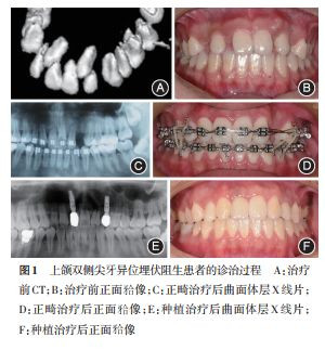 案例图片