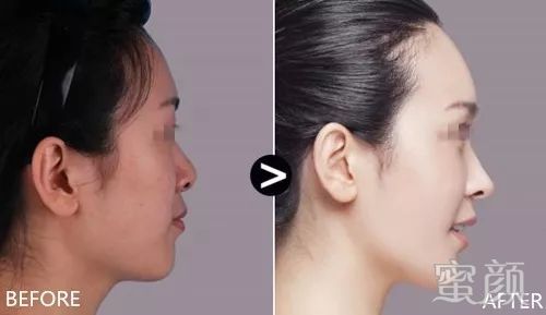 https://img.miyanlife.com/mnt/timg/200101/1623421N1-9.jpg