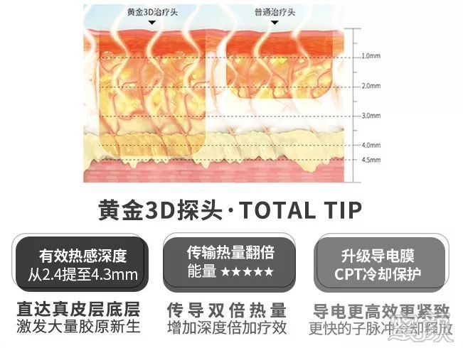 https://img.miyanlife.com/mnt/timg/200101/162555O28-5.jpg