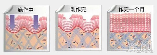 https://img.miyanlife.com/mnt/timg/200101/16255K100-7.jpg
