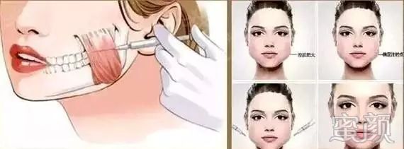 https://img.miyanlife.com/mnt/timg/200102/1302155222-9.jpg