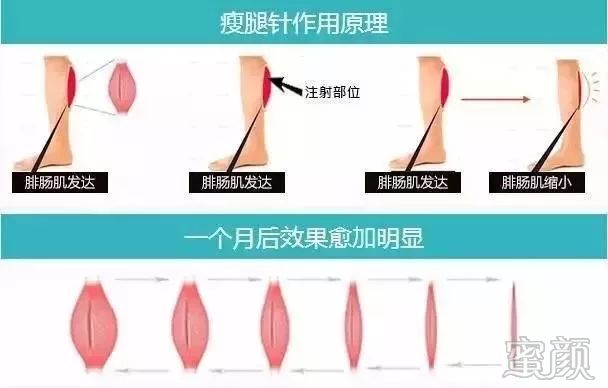 https://img.miyanlife.com/mnt/timg/200102/1302163W4-10.jpg