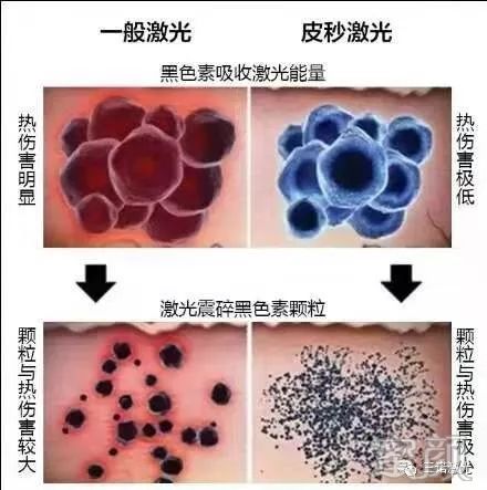 https://img.miyanlife.com/mnt/timg/200102/1442191918-3.jpg