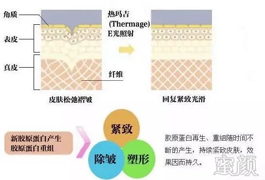 https://img.miyanlife.com/mnt/timg/200103/12140KI6-2.jpg