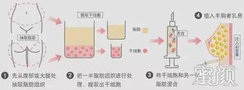 https://img.miyanlife.com/mnt/timg/200103/132333G57-4.jpg