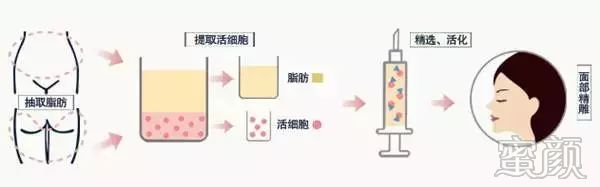 https://img.miyanlife.com/mnt/timg/200103/132334MD-6.jpg