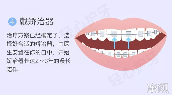 案例图片