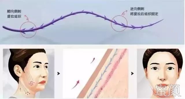 https://img.miyanlife.com/mnt/timg/200103/13420M2U-1.jpg