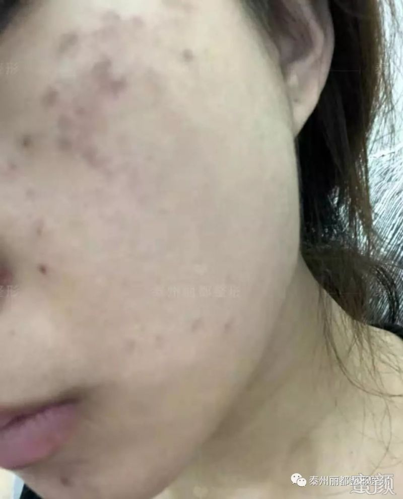 https://img.miyanlife.com/mnt/timg/200103/13451914R-2.jpg