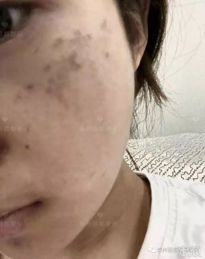 https://img.miyanlife.com/mnt/timg/200103/1345222a2-3.jpg
