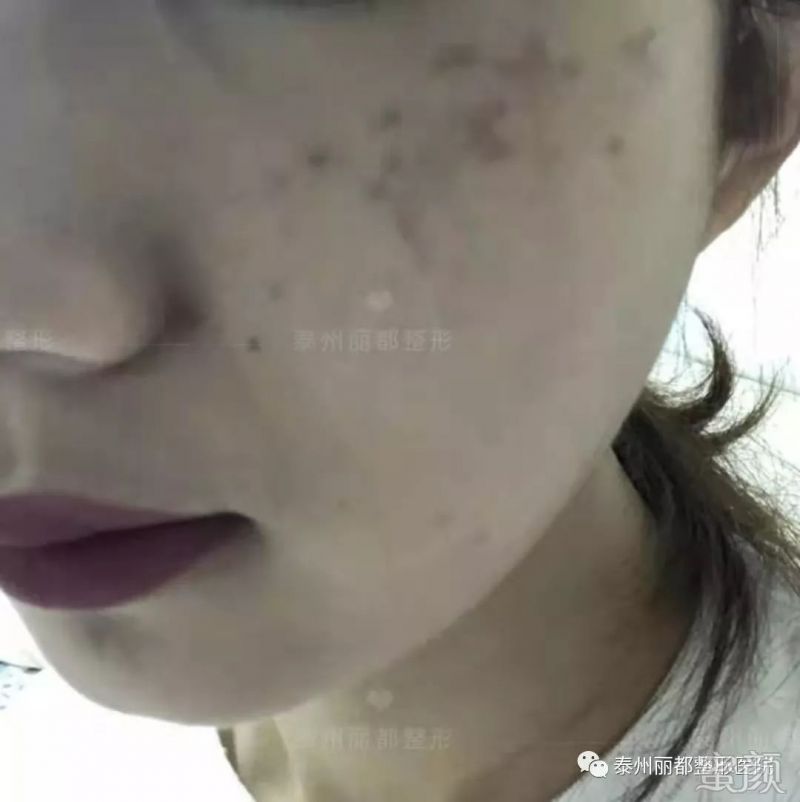 https://img.miyanlife.com/mnt/timg/200103/134523FH-4.jpg