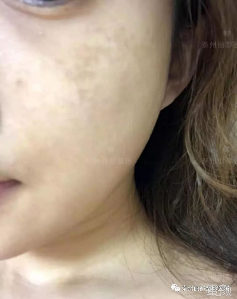 https://img.miyanlife.com/mnt/timg/200103/1345245V3-6.jpg
