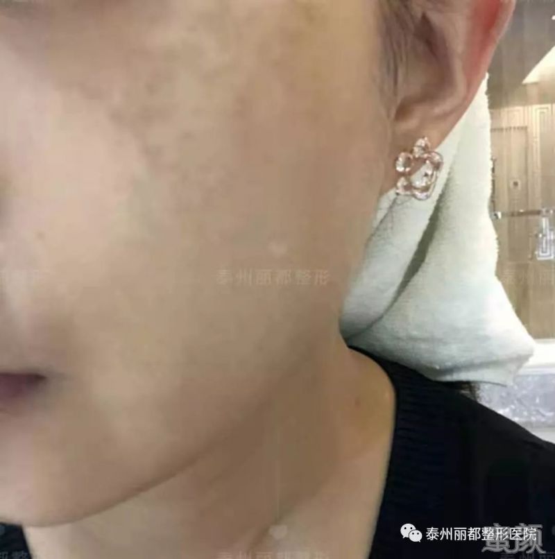 https://img.miyanlife.com/mnt/timg/200103/13452H4F-8.jpg