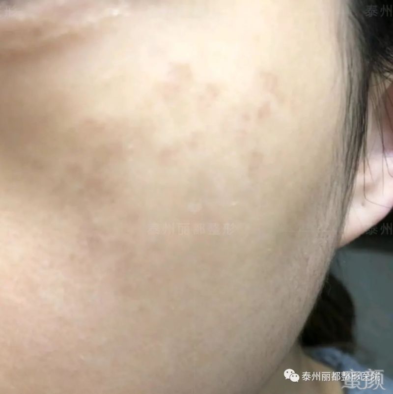 https://img.miyanlife.com/mnt/timg/200103/13452R337-9.jpg