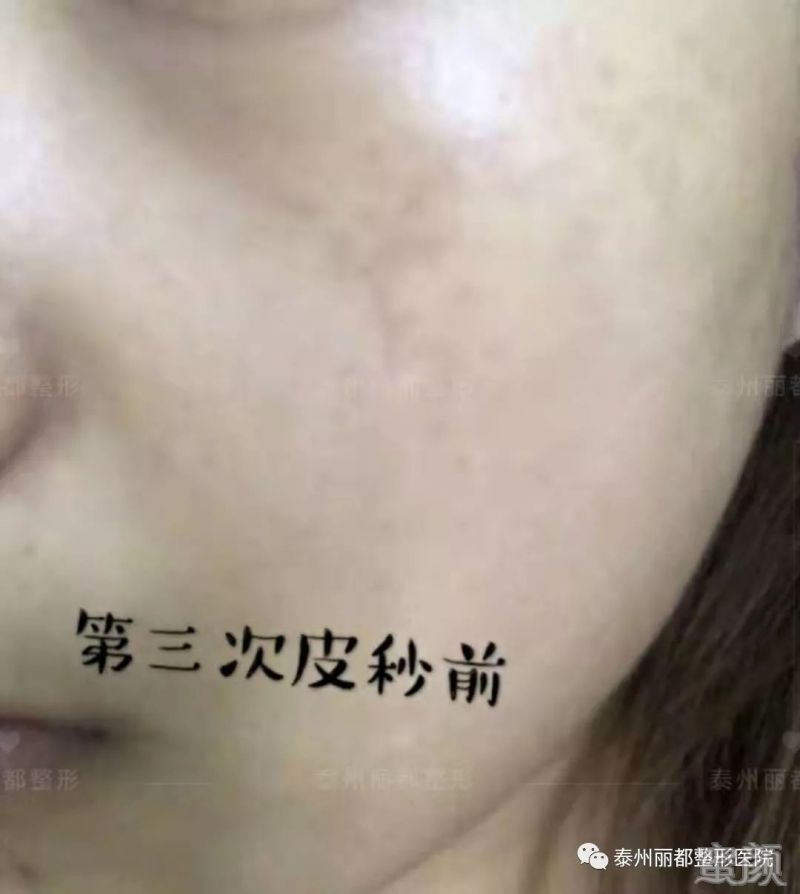 https://img.miyanlife.com/mnt/timg/200103/1345301L9-12.jpg