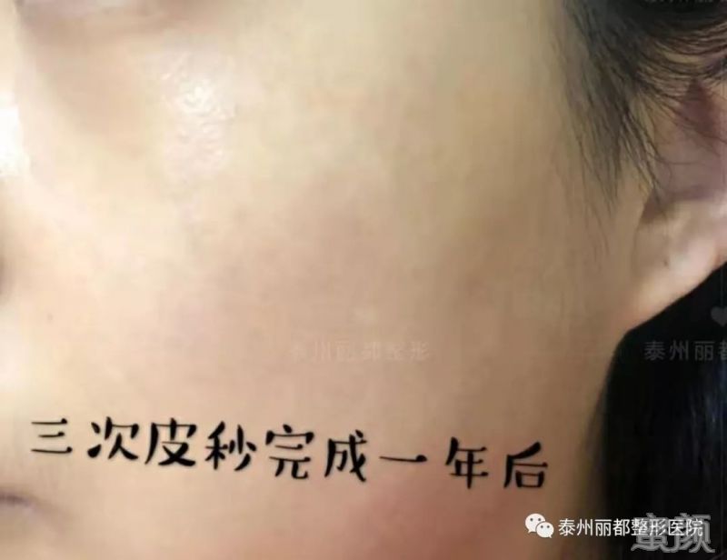 https://img.miyanlife.com/mnt/timg/200103/13453023H-13.jpg