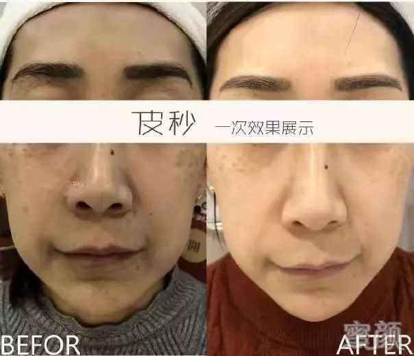 https://img.miyanlife.com/mnt/timg/200103/134F01429-5.jpg