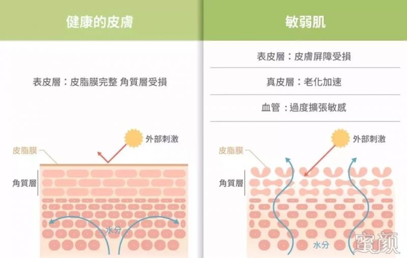 https://img.miyanlife.com/mnt/timg/200103/134RGW9-1.jpg