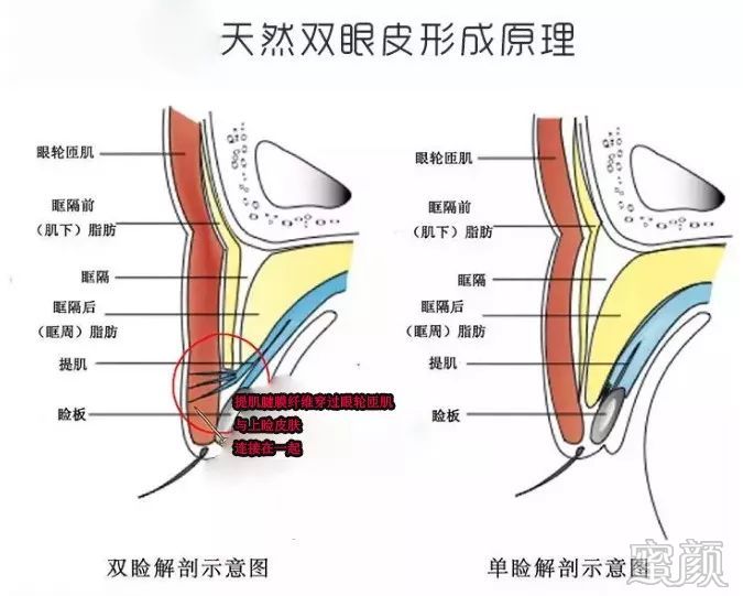 案例图片