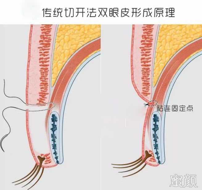 案例图片