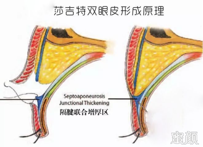 案例图片